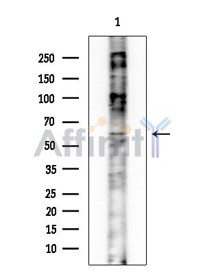 IQCB1 Antibody - Western blot analysis of extracts from Mouse brain, using IQCB1 Antibody at 1/1000 dilution.