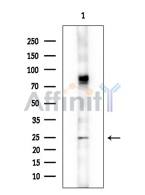 MLF1 Antibody - Western blot analysis of extracts from COLO205 cells, using MLF1 Antibody at 1/1000 dilution.