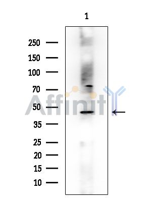 SLC9A3R2 Antibody - Western blot analysis of extracts from HUVEC cells, using SLC9A3R2 Antibody at 1/1000 dilution.