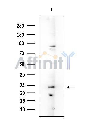 NMS Antibody - Western blot analysis of extracts from COLO205 cells, using NMS Antibody at 1/1000 dilution.