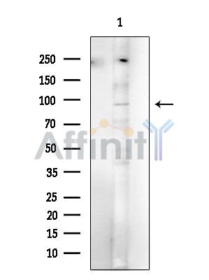 NUP93 Antibody - Western blot analysis of extracts from COLO205 cells, using NUP93 Antibody at 1/1000 dilution.