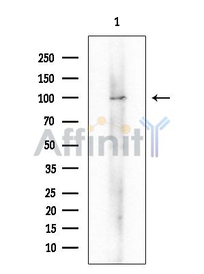 NOC3L Antibody - Western blot analysis of extracts from COLO205 cells, using NOC3L Antibody at 1/1000 dilution.
