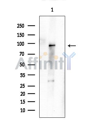 NOC3L Antibody - Western blot analysis of extracts from HUVEC cells, using NOC3L Antibody at 1/1000 dilution.