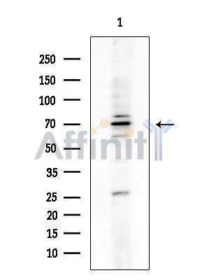 N4BP2L2 Antibody - Western blot analysis of extracts from COLO205 cells, using N4BP2L2 Antibody at 1/1000 dilution.