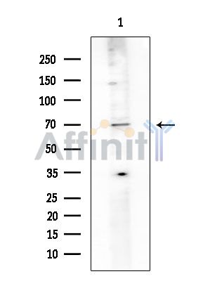 N4BP2L2 Antibody - Western blot analysis of extracts from HUVEC cells, using N4BP2L2 Antibody at 1/1000 dilution.