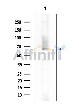 N4BP2L2 Antibody - Western blot analysis of extracts from Mouse brain, using N4BP2L2 Antibody at 1/1000 dilution.