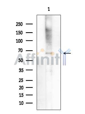 N4BP2L2 Antibody - Western blot analysis of extracts from Rat brain, using N4BP2L2 Antibody at 1/1000 dilution.