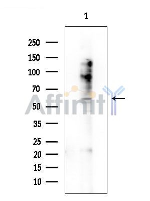 KCND1 Antibody - Western blot analysis of extracts from COLO205 cells, using KCND1 Antibody at 1/1000 dilution.