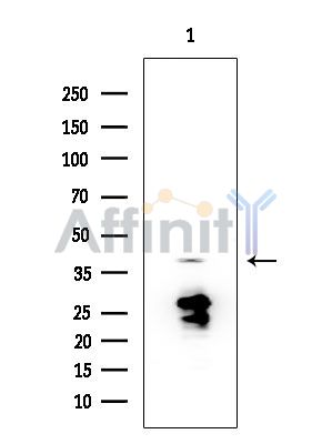 PRPF38A Antibody - Western blot analysis of extracts from HUVEC cells, using PRPF38A Antibody at 1/1000 dilution.