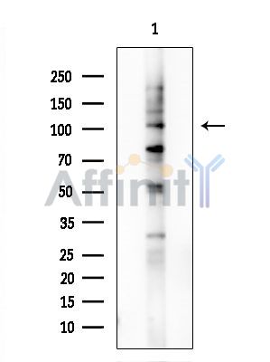 RAB3GAP1 Antibody - Western blot analysis of extracts from COLO205 cells, using RAB3GAP1 Antibody at 1/1000 dilution.