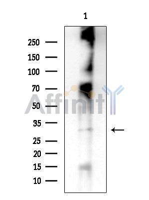RAB18 Antibody - Western blot analysis of extracts from HUVEC cells, using RAB18 Antibody at 1/1000 dilution.