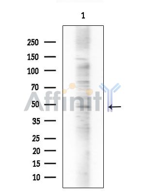 RFPL4A Antibody - Western blot analysis of extracts from COLO205 cells, using RFPL4A Antibody at 1/1000 dilution.