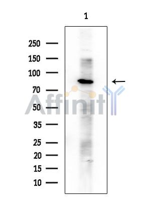 NEK5 Antibody - Western blot analysis of extracts from COLO205 cells, using NEK5 Antibody at 1/1000 dilution.