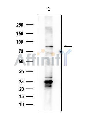 NEK5 Antibody - Western blot analysis of extracts from HUVEC cells, using NEK5 Antibody at 1/1000 dilution.