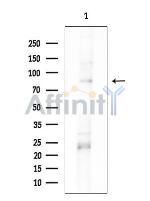 NEK5 Antibody - Western blot analysis of extracts from Rat brain, using NEK5 Antibody at 1/1000 dilution.