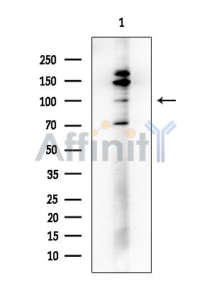 SFRS8 Antibody - Western blot analysis of extracts from COLO205 cells, using SFRS8 Antibody at 1/1000 dilution.