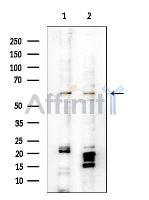 TIGD1 Antibody - Western blot analysis of extracts from various samples, using TIGD1 Antibody at 1/1000 dilution.
