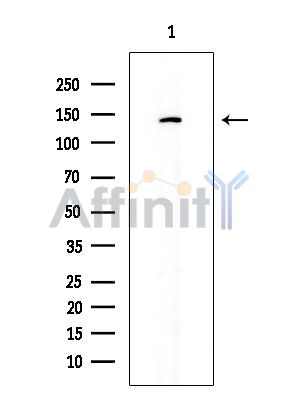 TIE1 Antibody - Western blot analysis of extracts from COLO205 cells, using TIE1 Antibody at 1/1000 dilution.