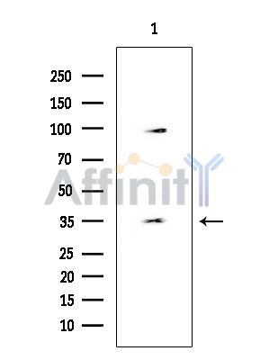 ZNF771 Antibody - Western blot analysis of extracts from HUVEC cells, using ZNF771 Antibody at 1/1000 dilution.