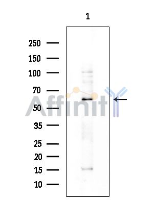 IGFALS Antibody - Western blot analysis of extracts from COLO205 cells, using IGFALS Antibody at 1/1000 dilution.
