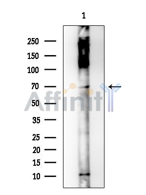 NPAS1 Antibody - Western blot analysis of extracts from Rat brain, using NPAS1 Antibody at 1/1000 dilution.