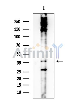 TNFRSF10D Antibody - Western blot analysis of extracts from COLO205 cells, using TNFRSF10D Antibody at 1/1000 dilution.