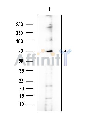 EMR3 Antibody - Western blot analysis of extracts from COLO205 cells, using EMR3 Antibody at 1/1000 dilution.