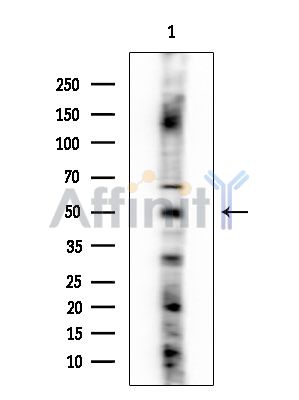 NK3R Antibody - Western blot analysis of extracts from Rat brain, using NK3R Antibody at 1/1000 dilution.