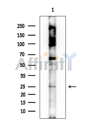 OR10AD1 Antibody - Western blot analysis of extracts from Rat brain, using OR10AD1 Antibody at 1/1000 dilution.