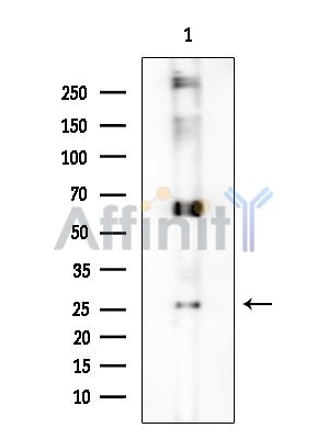 OR56B4 Antibody - Western blot analysis of extracts from Rat brain, using OR56B4 Antibody at 1/1000 dilution.