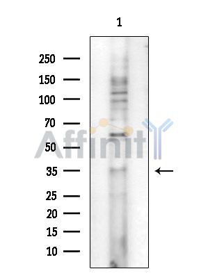 OR1A1 Antibody - Western blot analysis of extracts from COLO205 cells, using OR1A1 Antibody at 1/1000 dilution.