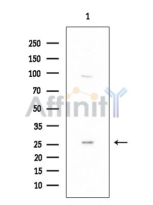 OR2I1 Antibody - Western blot analysis of extracts from Rat brain, using OR2I1 Antibody at 1/1000 dilution.