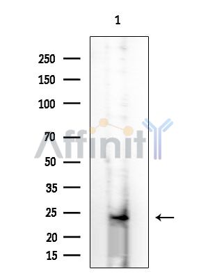 OR6P1 Antibody - Western blot analysis of extracts from HUVEC cells, using OR6P1 Antibody at 1/1000 dilution.