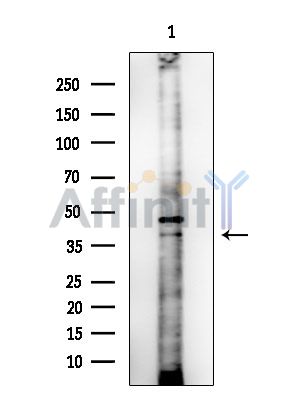 OR10H3/10H4 Antibody - Western blot analysis of extracts from COLO205 cells, using OR10H3/10H4 Antibody at 1/1000 dilution.