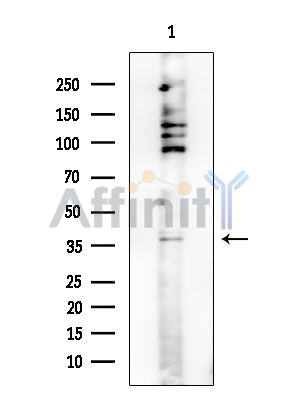 PAR4 Antibody - Western blot analysis of extracts from Rat brain, using PAR4 Antibody at 1/1000 dilution.