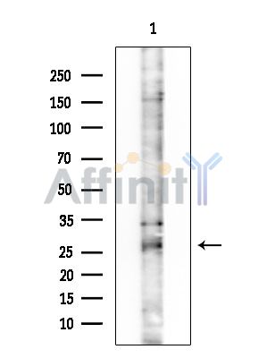 GPX5 Antibody - Western blot analysis of extracts from COLO205 cells, using GPX5 Antibody at 1/1000 dilution.