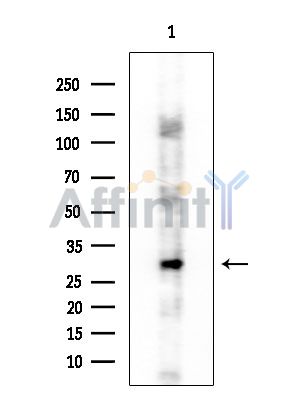 RNASE11 Antibody - Western blot analysis of extracts from COLO205 cells, using RNASE11 Antibody at 1/1000 dilution.