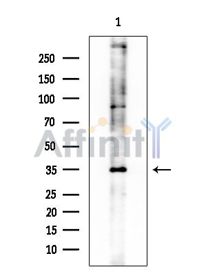 GAS2 Antibody - Western blot analysis of extracts from COLO205 cells, using GAS2 Antibody at 1/1000 dilution.
