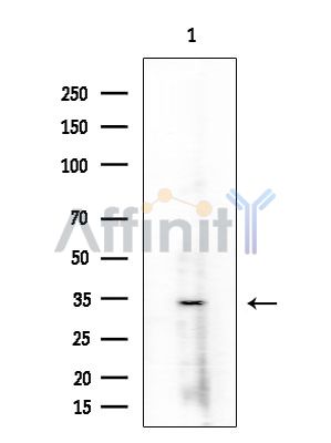 MICA Antibody - Western blot analysis of extracts from Rat brain, using MICA Antibody at 1/1000 dilution.