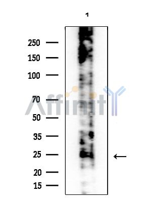 RBP4 Antibody - Western blot analysis of extracts from COLO205 cells, using RBP4 Antibody at 1/1000 dilution.