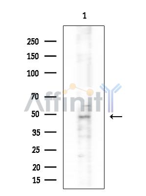 LKB1 Antibody - Western blot analysis of extracts from COLO205 cells, using LKB1 Antibody at 1/1000 dilution.