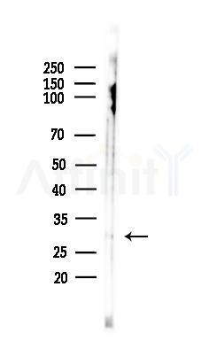 Neutrophil Elastase Antibody - Western blot analysis of lysates from HepG2 cells(starvation,24h treatment), using Neutrophil Elastase Antibody at 1/1000 dilution.