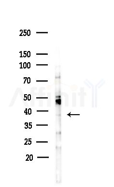 ERLN2 Antibody - Western blot analysis of lysates from COLO205 cells(heat-shock,45min treatment), using ERLN2 Antibody at 1/1000 dilution.