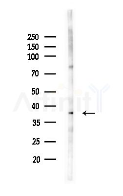 CAPG Antibody - Western blot analysis of lysates from MCF7 cells(heat-shock,45min treatment), using CAPG Antibody at 1/1000 dilution.