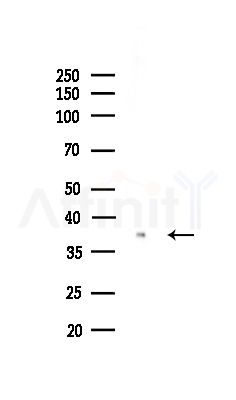 CAPG Antibody - Western blot analysis of lysates from COLO205 cells(UV,30min treatment), using CAPG Antibody at 1/1000 dilution.