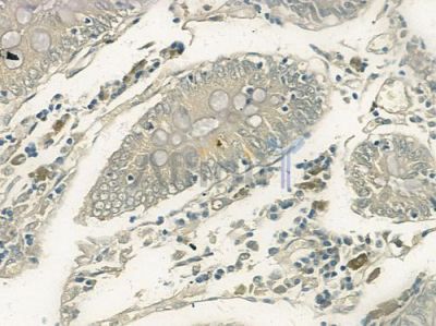 CD28 Antibody - AF0014 at 1/100 staining human normal colon tissue by IHC-P.