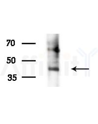 Phospho-CCR5 (Ser349) Antibody - Western blot analysis of extracts from Raji cells(heat-shock,45min treatment), using Phospho-CCR5 (Ser349) Antibody at 1/1000 dilution.