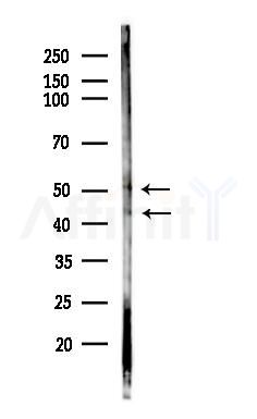 Phospho-CCR5 (Ser349) Antibody - Western blot analysis of lysates from Raji cells(heat-shock,45min treatment), using Phospho-CCR5 (Ser349) Antibody at 1/1000 dilution.