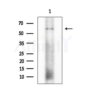 Phospho-ERK8 (Thr175+Tyr177) Antibody - Western blot analysis of lysates from COLO205 cells, using Phospho-ERK8 (Thr175+Tyr177) Antibody at 1/1000 dilution.