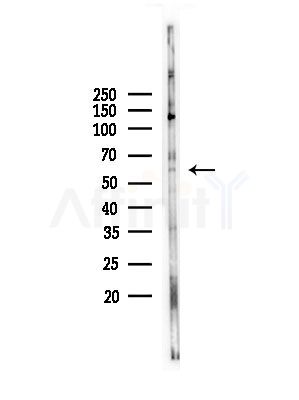 Phospho-ERK8 (Thr175+Tyr177) Antibody - Western blot analysis of lysates from COLO205 cells, using Phospho-ERK8 (Thr175+Tyr177) Antibody at 1/1000 dilution.